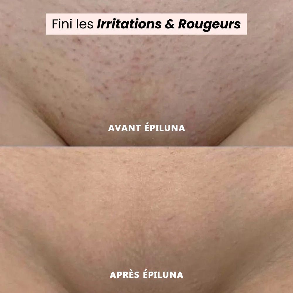 MoonaShave – Rasoir 2-en-1 Corps & Jambes